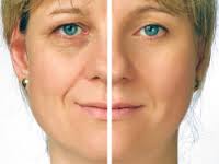 Mesoterapia Facial